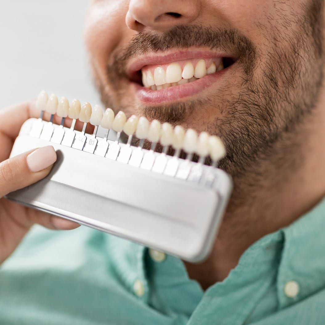 medicine, dentistry and healthcare concept - close up of dentist with tooth color samples choosing shade for male patient teeth at dental clinic